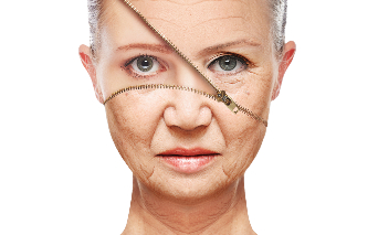 At the age of 30 years reduces the production of collagen, resulting in wrinkles