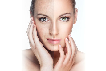 The result of the use of the cream VitalDermax becomes visible after 15 minutes
