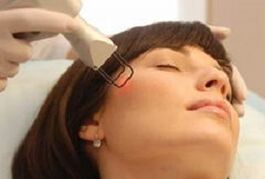 the essence of the fractional laser facial skin rejuvenation procedure