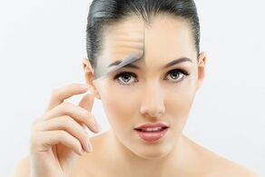 What skin problems does laser rejuvenation treat